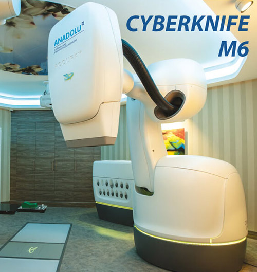 CyberKnife